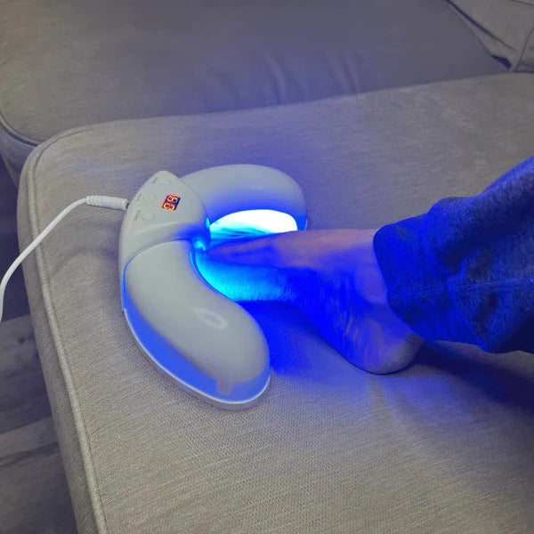 Innowacyjne Urządzenie Laserowe do Usuwania Grzybów Paznokci - Ręczne, Bezpieczne i Skuteczne 2