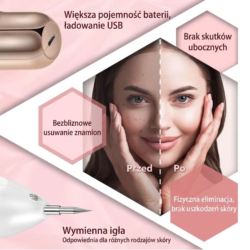 Długopis Plazmowy do Usuwania Znamion i Pieprzyków – 9 Poziomów Intensywności, Bezkrwawy Zabieg 9