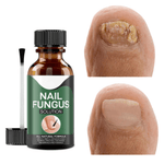 Krople do Leczenia Grzybicy Paznokci – Naturalne Olejki, 15 ml 0