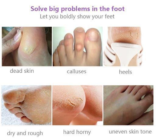 SilkyFeet - Złuszczająca Maska do Stóp z Kwasem Owocowym, Naturalne Składniki, 3 Pary 4